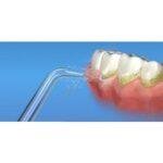 Waterpik Jt 100 Jet Tips Attachment For Water Flossers 2 Pieces Silver